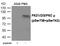 Protein Kinase D1 antibody, PA5-37822, Invitrogen Antibodies, Western Blot image 