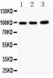 TNF Alpha Induced Protein 1 antibody, PA5-80141, Invitrogen Antibodies, Western Blot image 