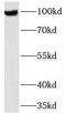 Transmembrane And Tetratricopeptide Repeat Containing 1 antibody, FNab08811, FineTest, Western Blot image 
