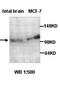 Annexin A11 antibody, orb77086, Biorbyt, Western Blot image 