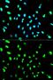 TAR DNA Binding Protein antibody, GTX32912, GeneTex, Immunofluorescence image 