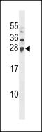 Ubiquitin Conjugating Enzyme E2 H antibody, 58-808, ProSci, Western Blot image 