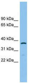 Aldo-Keto Reductase Family 1 Member C2 antibody, TA337630, Origene, Western Blot image 