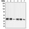 Matrix Metallopeptidase 13 antibody, MBS821505, MyBioSource, Western Blot image 