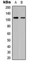 Death Domain Associated Protein antibody, LS-C358467, Lifespan Biosciences, Western Blot image 