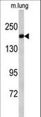 Alsin Rho Guanine Nucleotide Exchange Factor ALS2 antibody, LS-C99217, Lifespan Biosciences, Western Blot image 