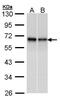 RAD9 Checkpoint Clamp Component A antibody, PA5-21275, Invitrogen Antibodies, Western Blot image 