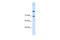 Solute Carrier Family 7 Member 4 antibody, 29-917, ProSci, Western Blot image 