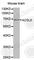 Acyl-CoA Synthetase Long Chain Family Member 5 antibody, A1270, ABclonal Technology, Western Blot image 