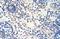 Ribonuclease H2 subunit A antibody, A07386, Boster Biological Technology, Immunohistochemistry paraffin image 