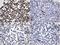 MutS Homolog 6 antibody, LS-C797055, Lifespan Biosciences, Immunohistochemistry paraffin image 