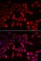 Glycogen Phosphorylase L antibody, LS-C334896, Lifespan Biosciences, Immunofluorescence image 