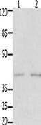 GDNF Family Receptor Alpha 3 antibody, TA321357, Origene, Western Blot image 