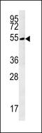 TRNA Methyltransferase 11 Homolog antibody, 61-911, ProSci, Western Blot image 