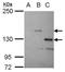 Serine/Threonine Kinase 31 antibody, GTX119718, GeneTex, Western Blot image 
