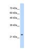 Cleavage And Polyadenylation Specific Factor 4 antibody, NBP1-57114, Novus Biologicals, Western Blot image 