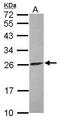 ATP Synthase F1 Subunit Beta antibody, PA5-30236, Invitrogen Antibodies, Western Blot image 