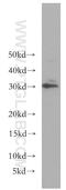 Bridging Integrator 3 antibody, 11215-1-AP, Proteintech Group, Western Blot image 