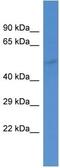 Gamma-Aminobutyric Acid Type A Receptor Alpha5 Subunit antibody, ab10098, Abcam, Western Blot image 