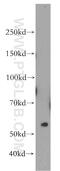 Carboxylesterase 5A antibody, 19520-1-AP, Proteintech Group, Western Blot image 