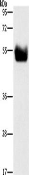 Ribose-phosphate pyrophosphokinase 1 antibody, TA349256, Origene, Western Blot image 