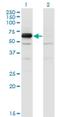 Dihydropyrimidinase Like 4 antibody, H00010570-M01, Novus Biologicals, Western Blot image 