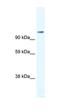 Forkhead Box P4 antibody, orb329919, Biorbyt, Western Blot image 