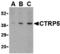 C1q And TNF Related 5 antibody, MBS150627, MyBioSource, Western Blot image 