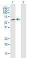 RAD23 Homolog B, Nucleotide Excision Repair Protein antibody, H00005887-D02P, Novus Biologicals, Western Blot image 