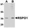 R-spondin-1 antibody, orb75203, Biorbyt, Western Blot image 
