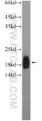 Zinc Finger Protein 747 antibody, 19901-1-AP, Proteintech Group, Western Blot image 