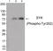 Spleen Associated Tyrosine Kinase antibody, 79-936, ProSci, Western Blot image 