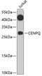 Centromere Protein Q antibody, 23-062, ProSci, Western Blot image 