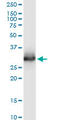 Chymotrypsin Like Elastase 3A antibody, LS-C133626, Lifespan Biosciences, Western Blot image 