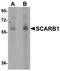 Scavenger Receptor Class B Member 1 antibody, orb75209, Biorbyt, Western Blot image 