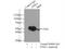 Inositol-Trisphosphate 3-Kinase A antibody, 14270-1-AP, Proteintech Group, Immunoprecipitation image 