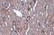 NFKB Inhibitor Alpha antibody, GTX110521, GeneTex, Immunohistochemistry paraffin image 