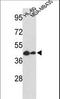 Gasdermin B antibody, LS-C166693, Lifespan Biosciences, Western Blot image 