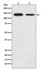 Growth Hormone Receptor antibody, M00698-1, Boster Biological Technology, Western Blot image 