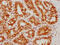 ATF4 antibody, CSB-RA002272A0HU, Cusabio, Immunohistochemistry paraffin image 