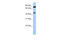 SET And MYND Domain Containing 3 antibody, 30-645, ProSci, Enzyme Linked Immunosorbent Assay image 