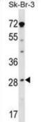 Steroidogenic Acute Regulatory Protein antibody, abx028894, Abbexa, Western Blot image 