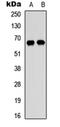 Cyclin Dependent Kinase Inhibitor 1B antibody, orb129710, Biorbyt, Western Blot image 