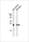 Ubiquitin C-Terminal Hydrolase L1 antibody, LS-B9320, Lifespan Biosciences, Western Blot image 