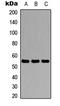 Serpin Family C Member 1 antibody, LS-C354300, Lifespan Biosciences, Western Blot image 