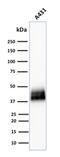 Tumor Associated Calcium Signal Transducer 2 antibody, GTX17970, GeneTex, Western Blot image 