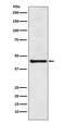 Eukaryotic Translation Initiation Factor 4A3 antibody, M03095-1, Boster Biological Technology, Western Blot image 