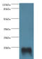 Troponin C2, Fast Skeletal Type antibody, LS-B15195, Lifespan Biosciences, Western Blot image 