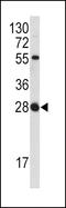 Fibroblast growth factor 18 antibody, LS-B10539, Lifespan Biosciences, Western Blot image 