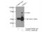 Epoxide Hydrolase 2 antibody, 10833-1-AP, Proteintech Group, Immunoprecipitation image 